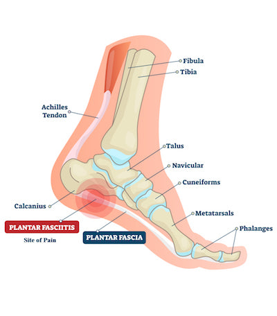 ZaTech Plantar Fasciitis compression socks; image of the foot anatomy, showing plantar fascia, bones and ligaments. 