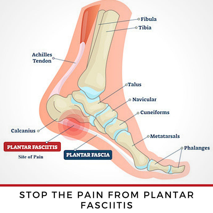 ZaTech Plantar Fasciitis Compression Socks - a diagram of the foot with plantar fascia, ligaments and bone structure. Text reads Stop the pain from plantar fasciitis